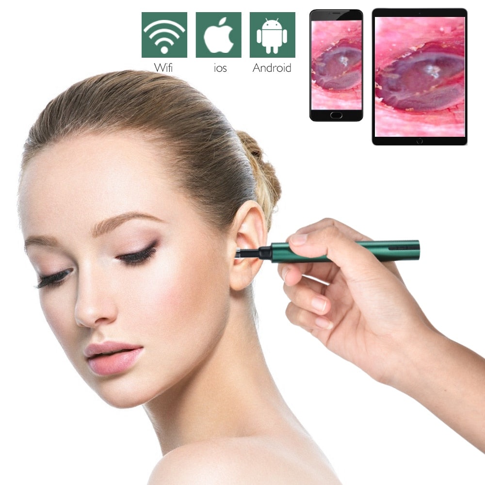 Wireless WiFi Ear Otoscope Oto Speculum Ultra-Thin Ear Scope Camera Waterproof Earwax Removal Tool